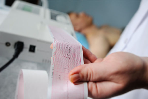 Hombre recostado mientras toman un electrocardiograma en reposo